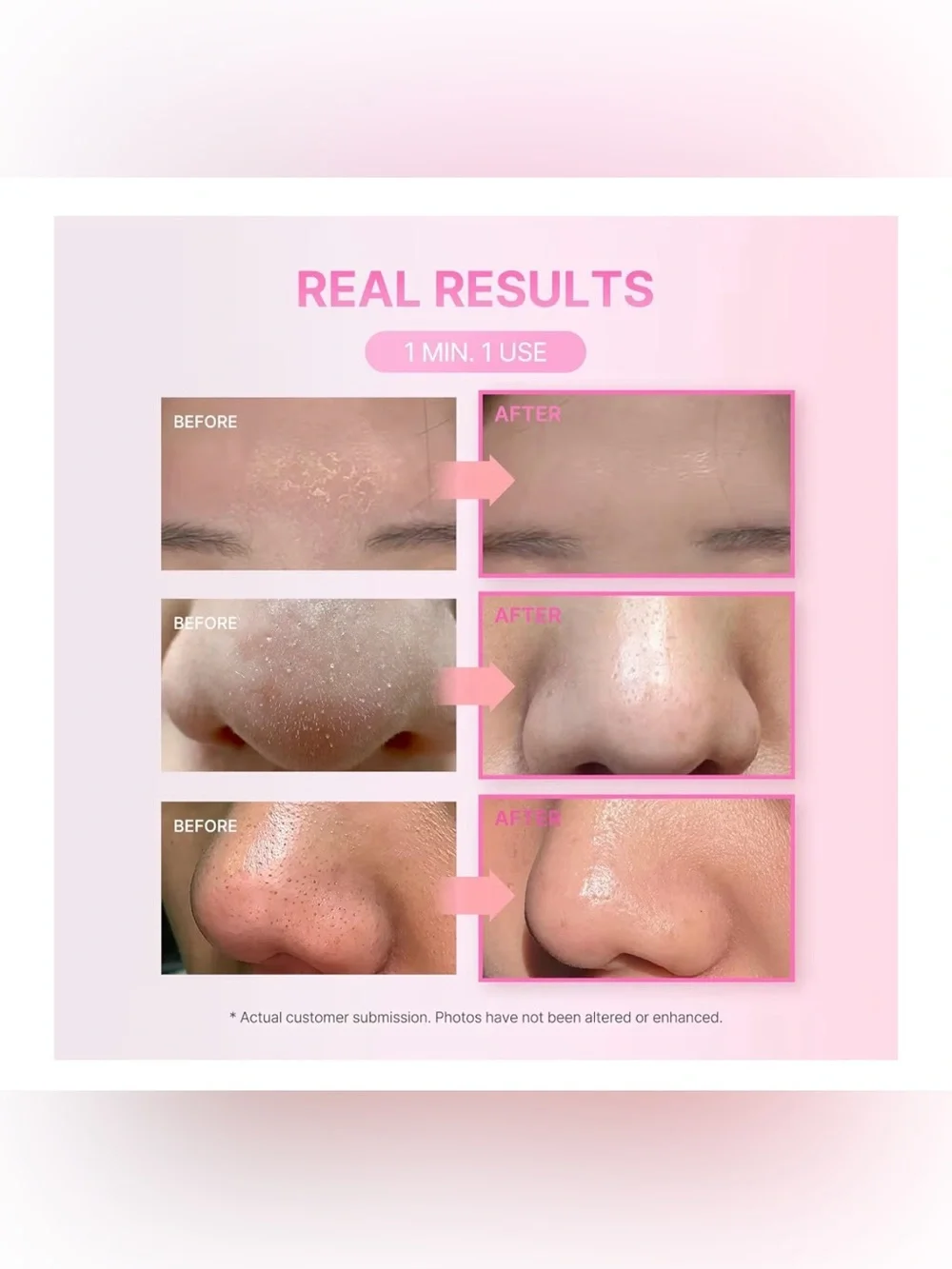 LEPS soft dewy